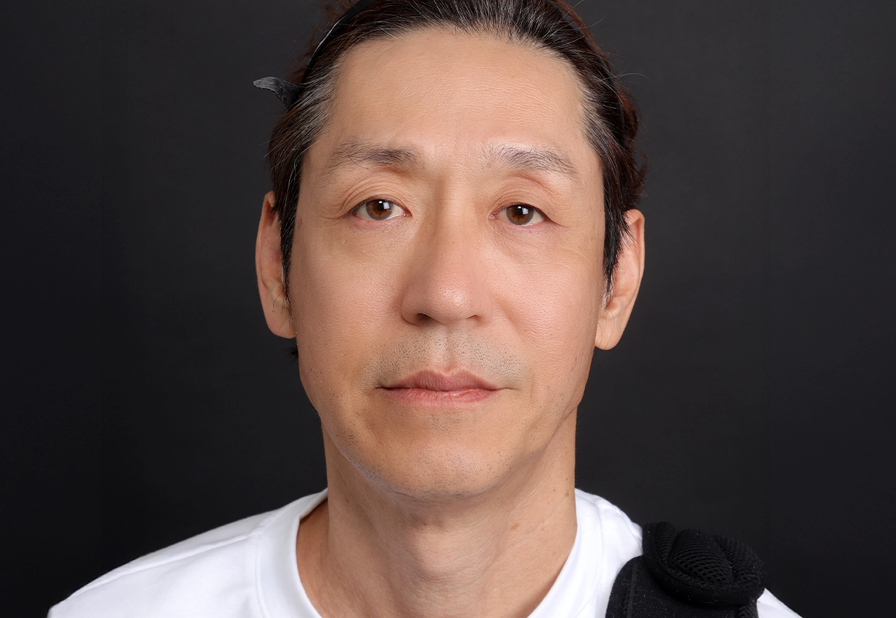 잔주름 시술 후