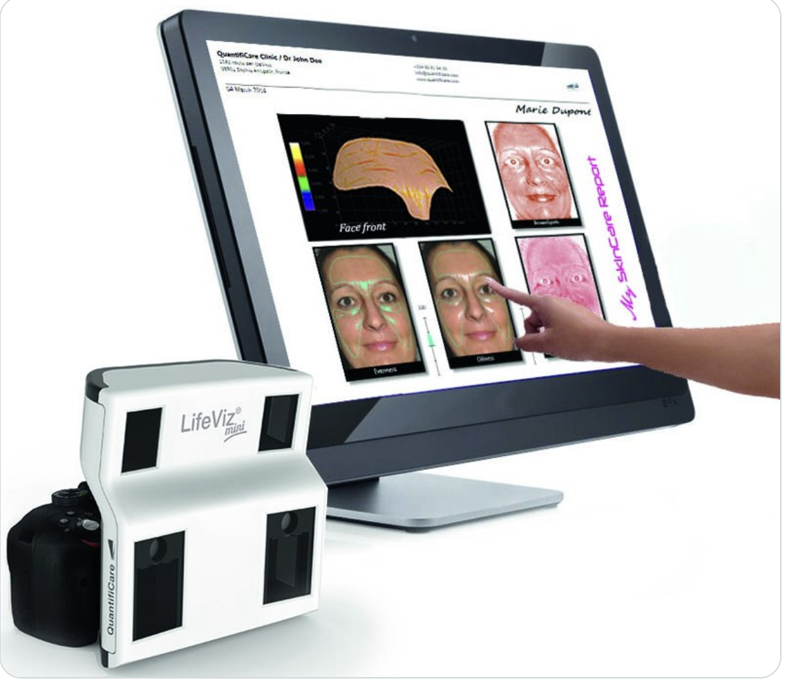 QuantifiCare LifeViz Mini Pro - 3D 스테레오포토그래메트리 피부 분석 시스템
